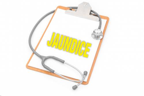 Home Remedies for Jaundice